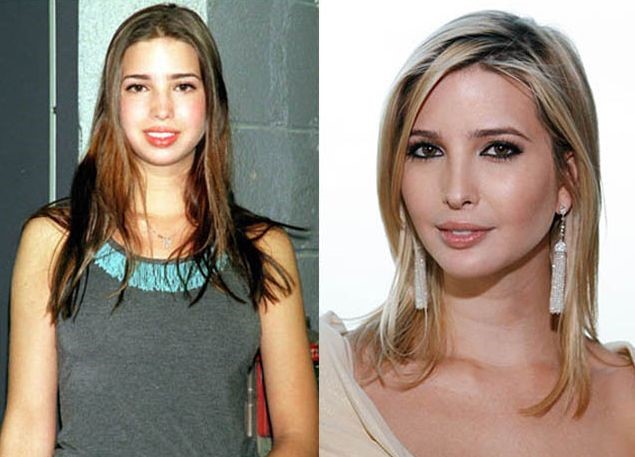 ivanka-before-and-after