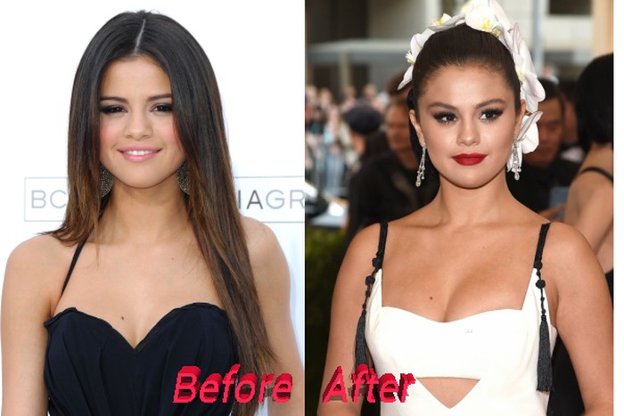 Selena Gomez Plastic Surgery Or Special Make Up Really Lights