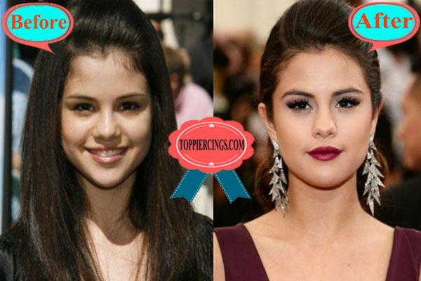 selena gomez plastic surgery