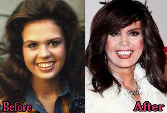 Marie Osmond then and now.