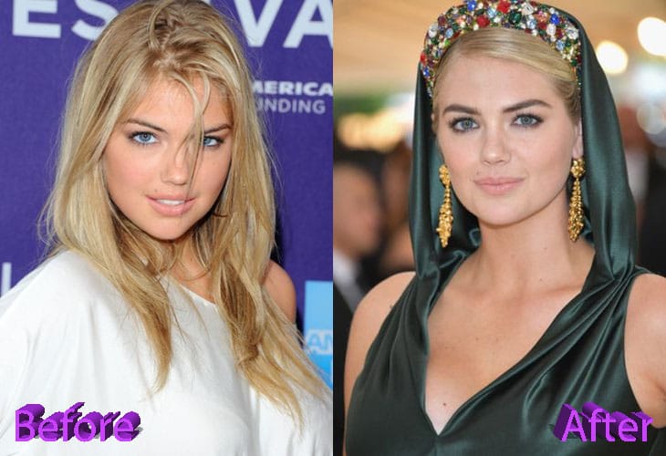 kate upton before and after