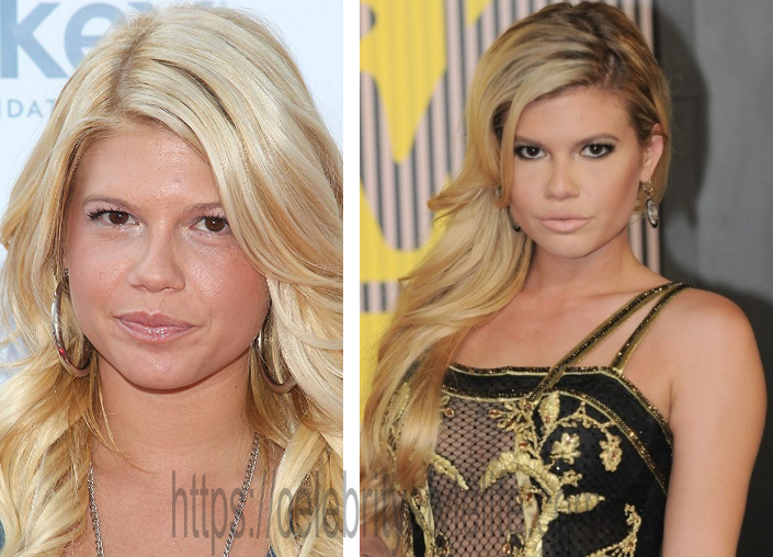 chanel west coast breast size