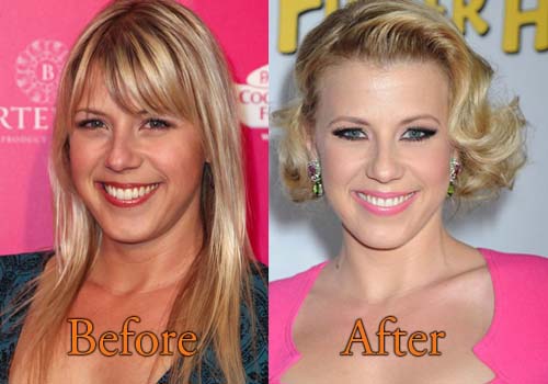 Jodie Sweetin Plastic Surgery