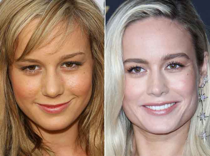 Brie Larson Plastic Surgery Before as well as After - Lights Fashion Beauty...